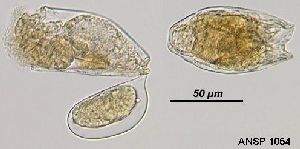  Image courtesy of ANSP (Jersabek et al. 2003) <a href='../../Reference/Index/15798' target='_blank'>[Ref.15798]</a>; females, dorsal (right) and lateral (left) views.  Left specimen with subitaneous egg.